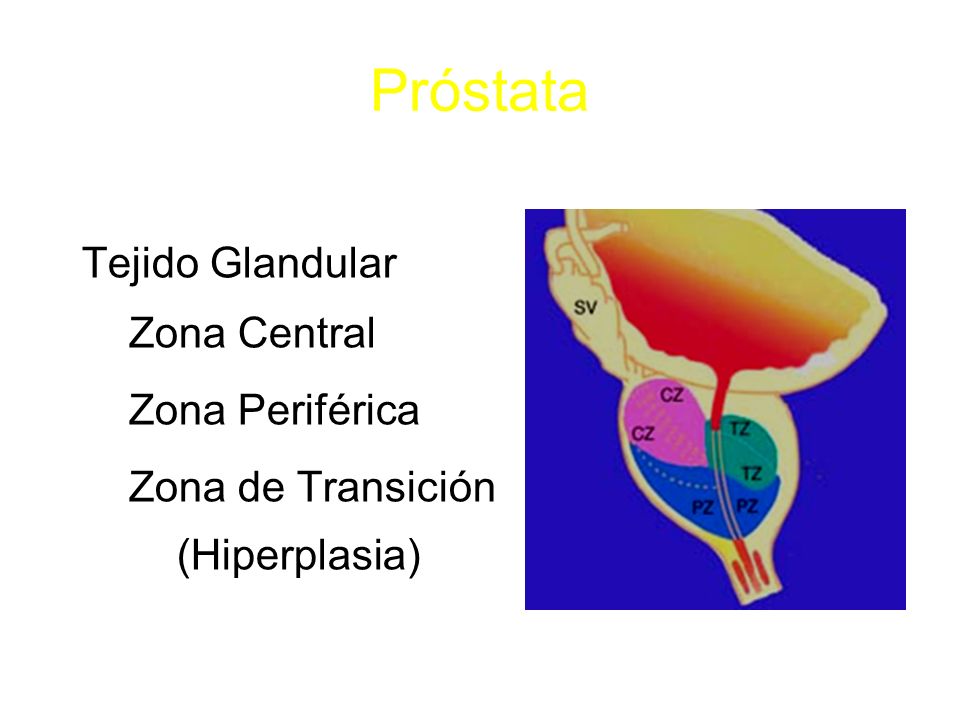 área de transición de próstata